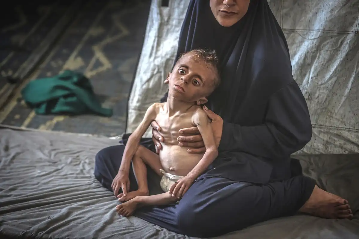 Fome é confirmada em Gaza pela primeira vez, ONU pede ajuda urgente