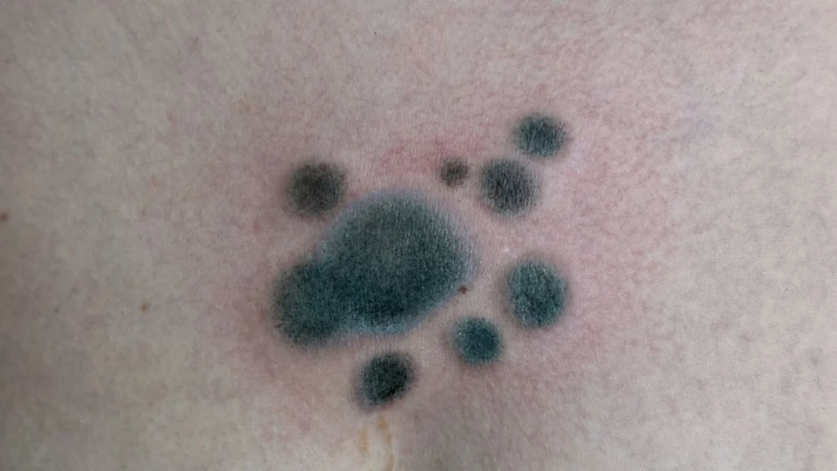 Tatuagens que imitam manchas de mofo chamam atenção da web; veja fotos